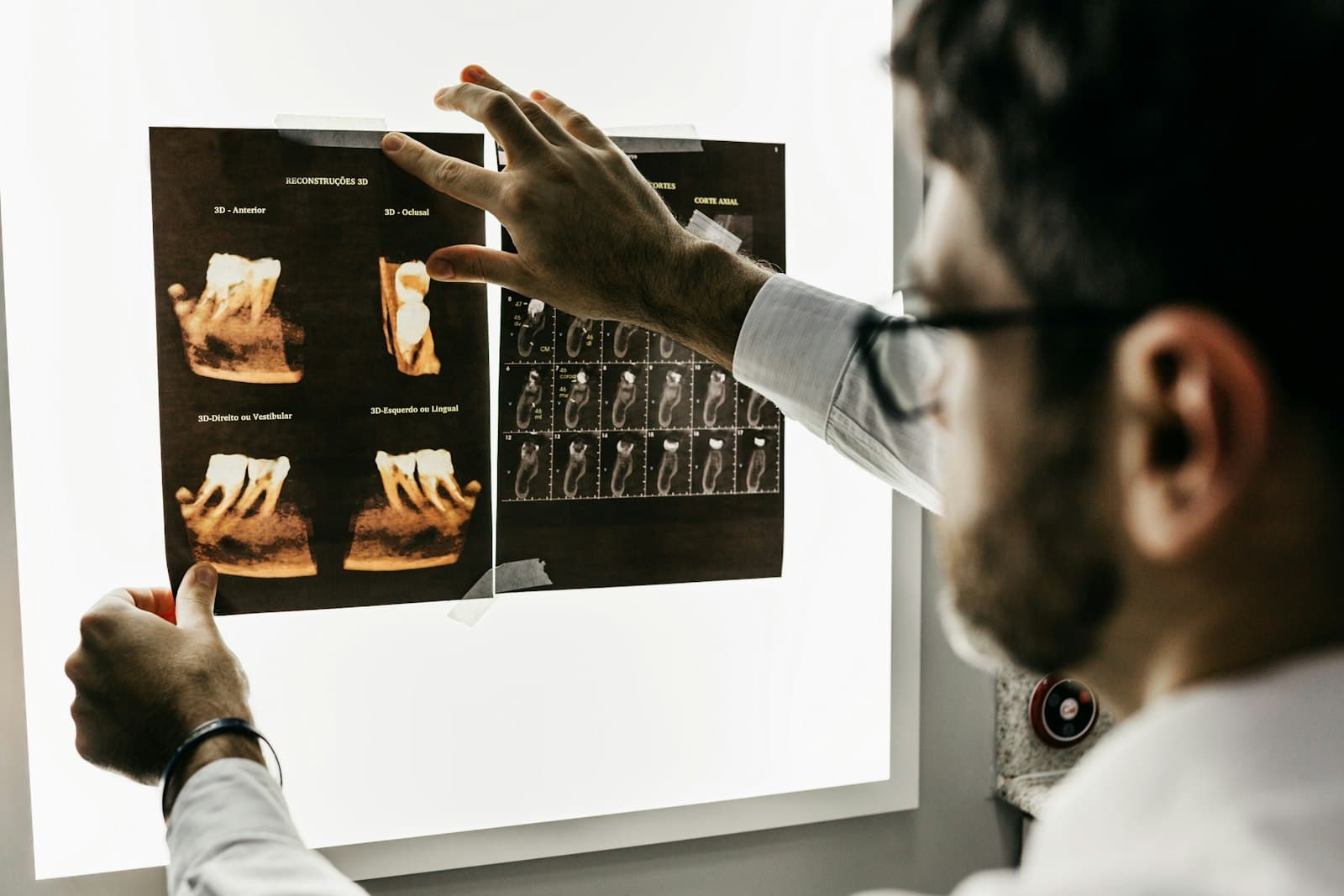A dentist reviewing dental X-ray images on a light box